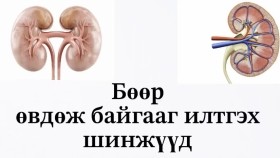 ᠪᠥᠭᠡᠷ᠎ᠡ ᠡᠪᠡᠳᠴᠢᠯᠡᠭᠰᠡᠨ ᠲᠣᠬᠢᠶᠠᠯᠳᠤᠯ ᠳ᠋ᠤ᠌ ᠶᠠᠮᠠᠷ ᠰᠢᠨᠵᠢ ᠲᠡᠮᠳᠡᠭ ᠢᠯᠡᠷᠡᠳᠡᠭ ᠪᠣᠢБөөр өвчилсөн тохиолдолд ямар шинж тэмдэг илэрдэг вэ